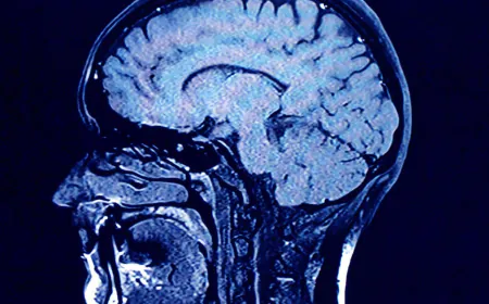 Study finds growing levels of microplastics in human brains